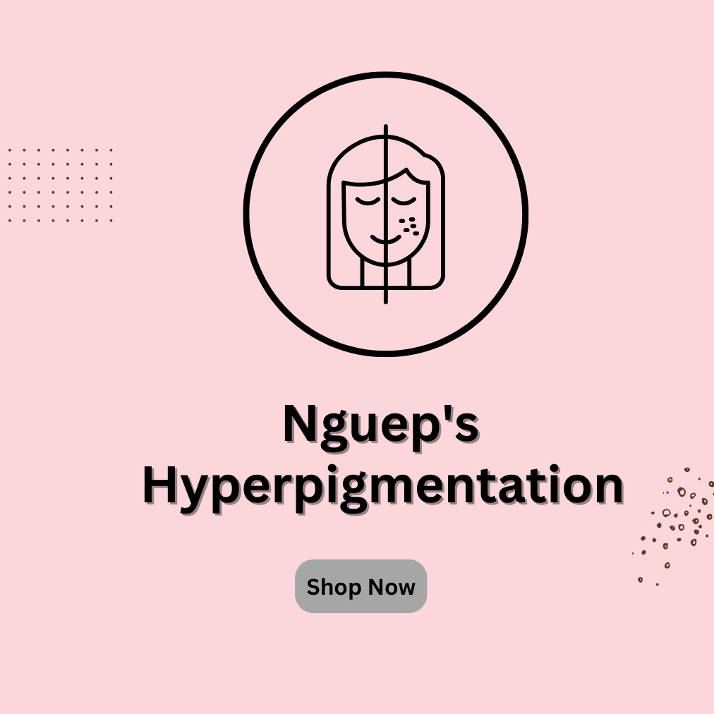 Hyperpigmentation